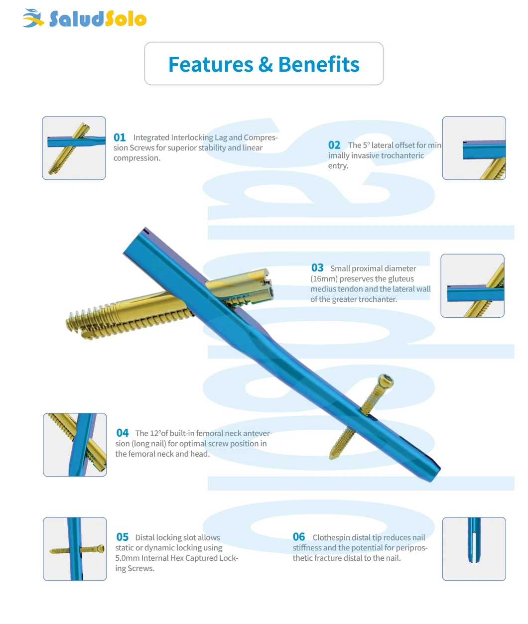 Orthopedic Surgical Implant for Trauma Surgery, Standard Proximal Femoral Intertrochanteric Antegrade Nails, Intertan Intramedullary Nail System